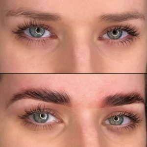 Before After Milook 1